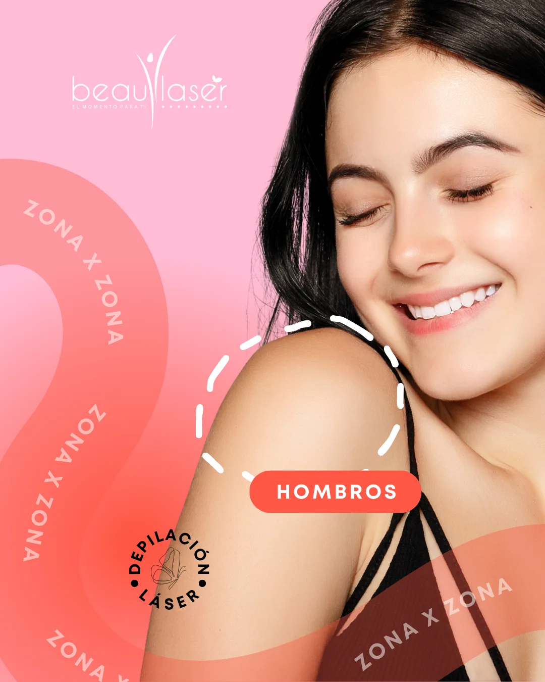 Depilación láser — hombros