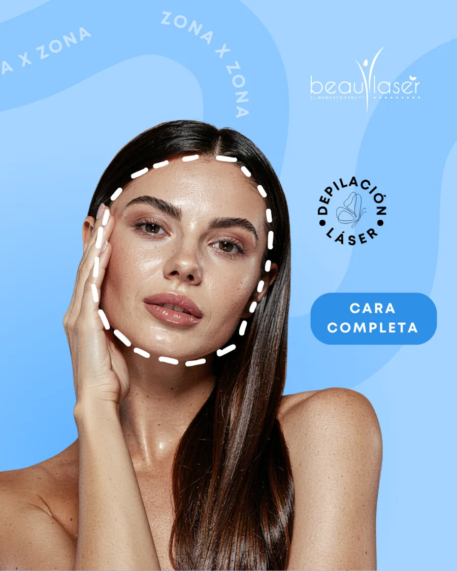 Depilación láser — cara completa