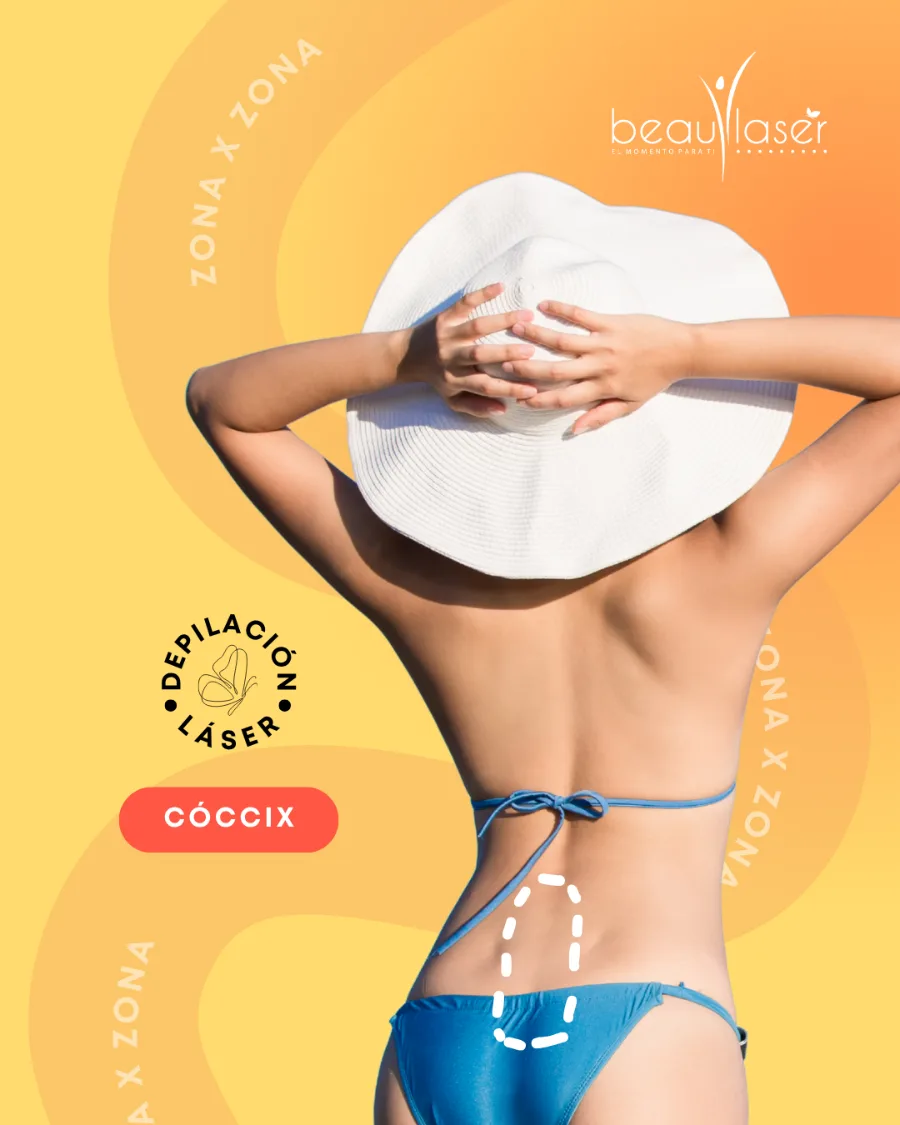 Depilación láser — cóccix