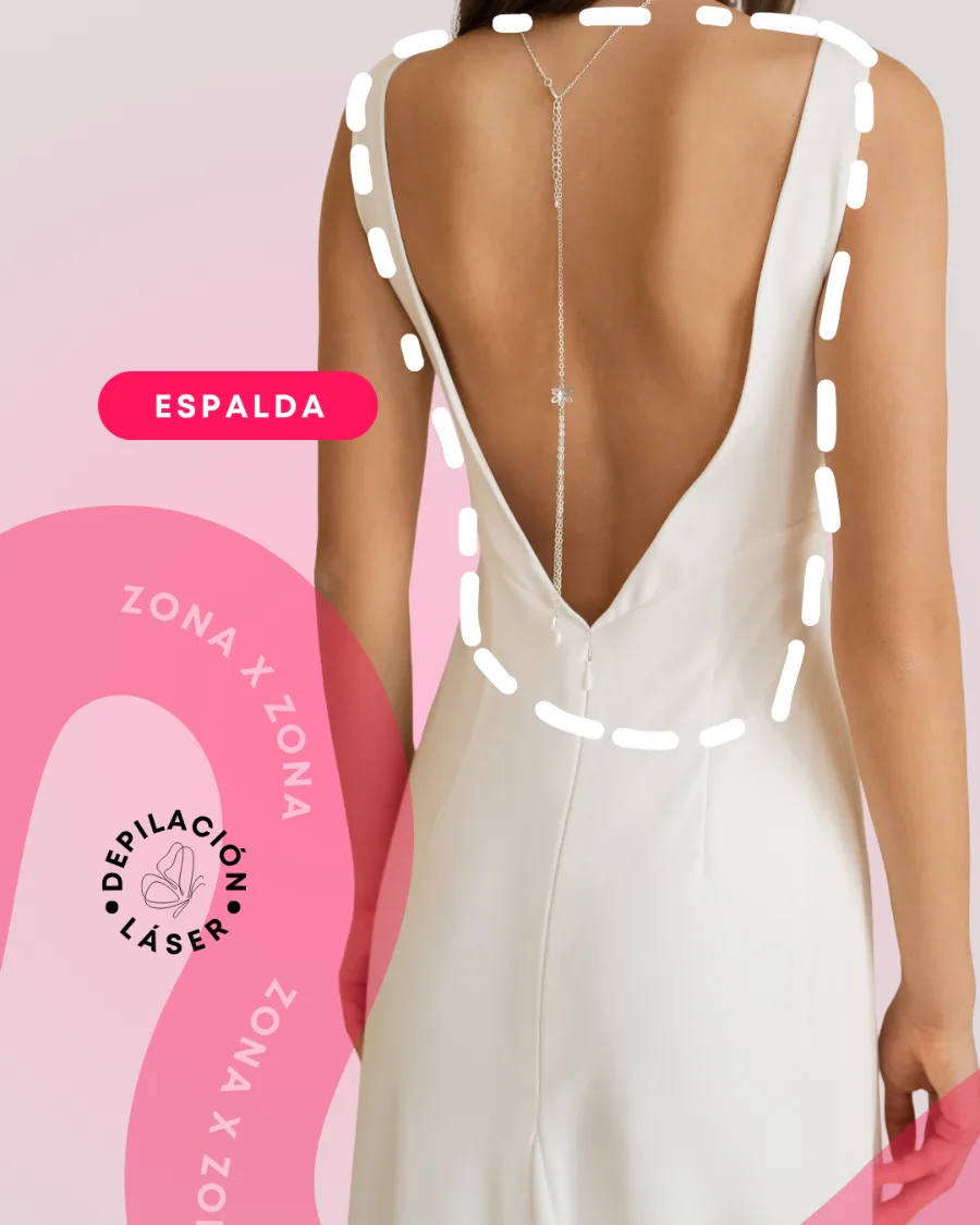 Depilación láser — espalda